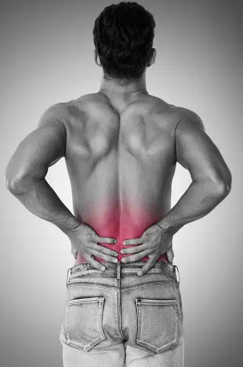 radiculopatía crónica