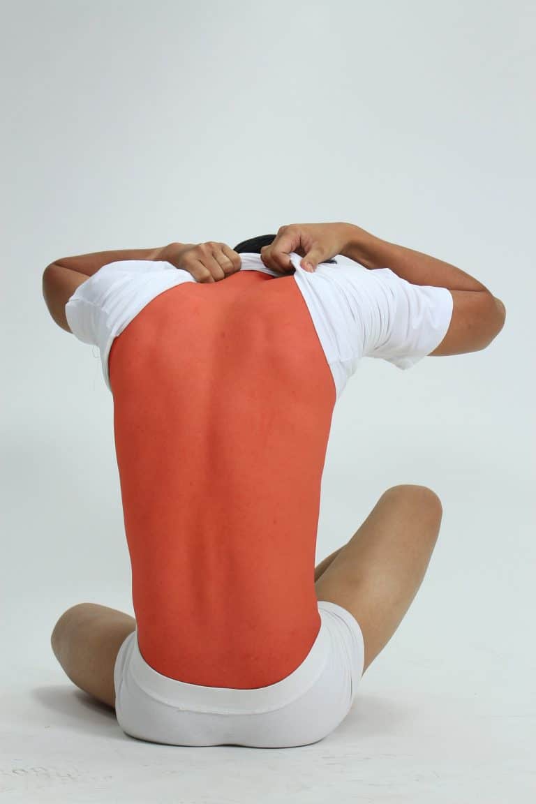 incapacidad raquialgia