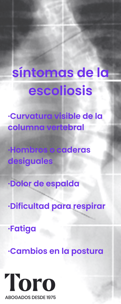 síntomas de la escoliosis