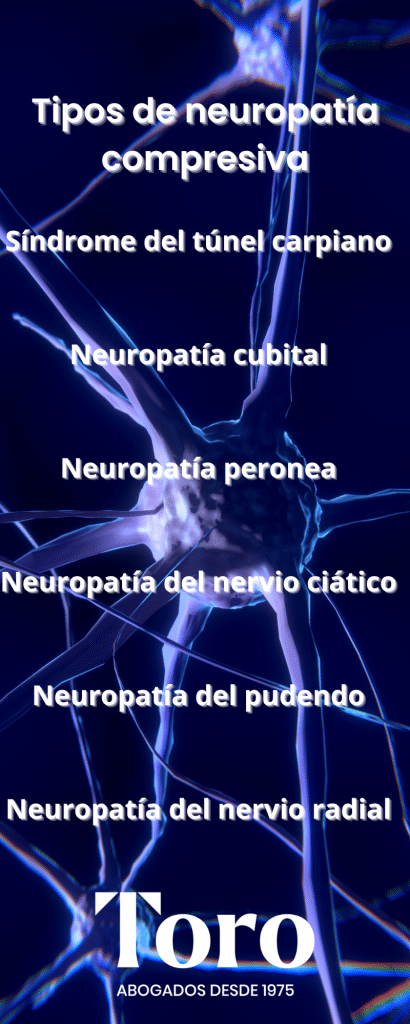 neuropatía compresiva