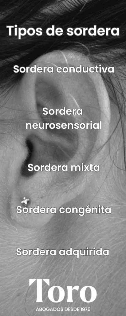 Tipos de sordera